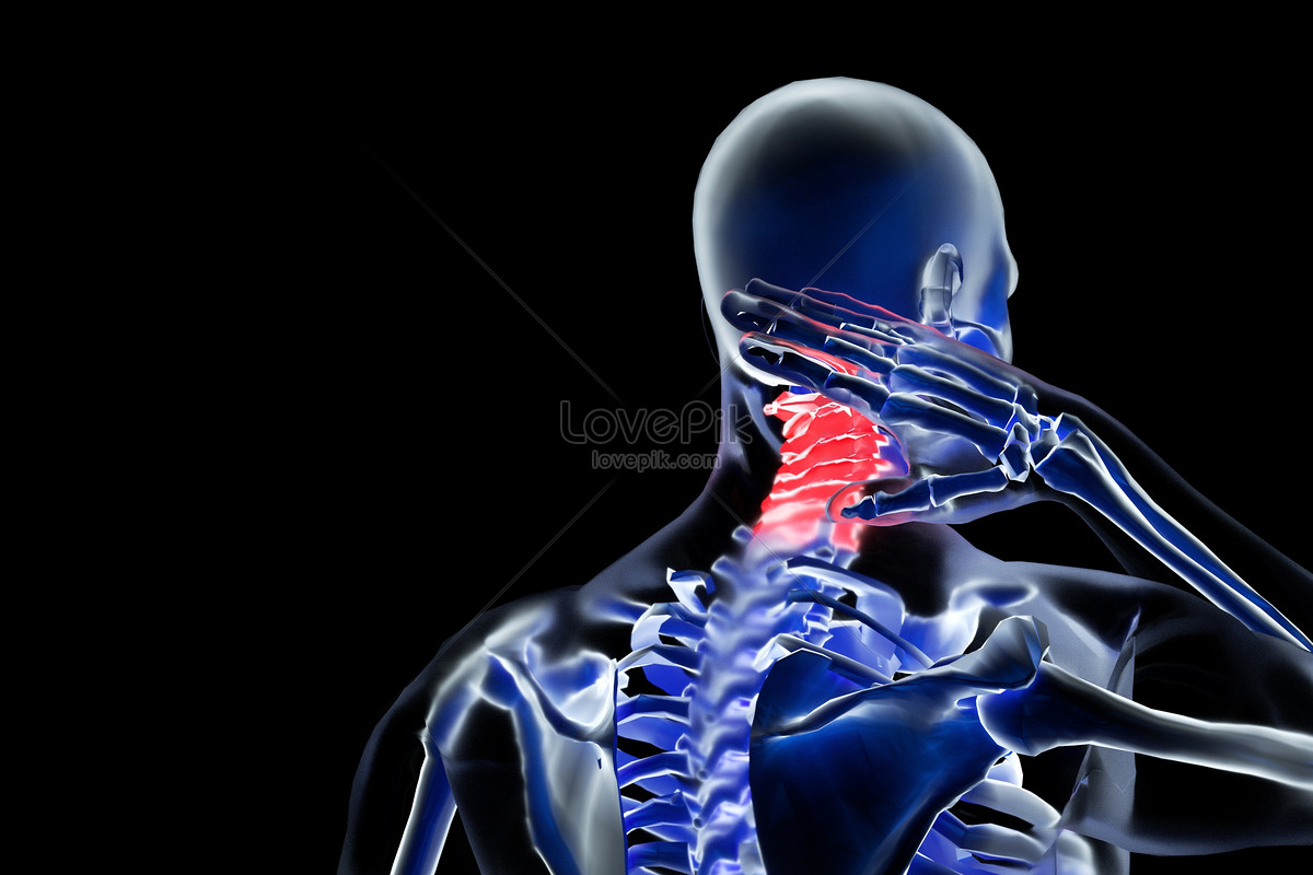 Photo de Scène De Spondylose Cervicale En Trois Dimensions