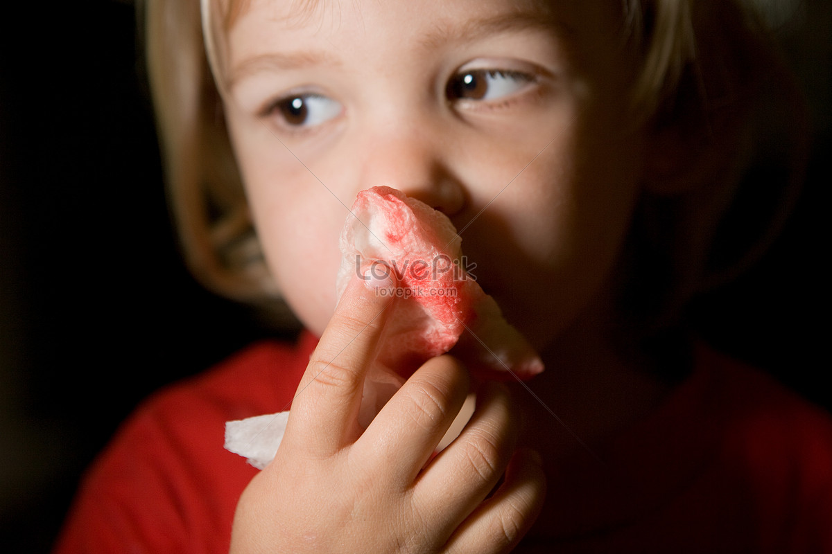 Носовое кровотечение является. Носовое кровотечение у детей. Носовоекровотечениеудетец. Нлсовоеткровоьечение у детей.