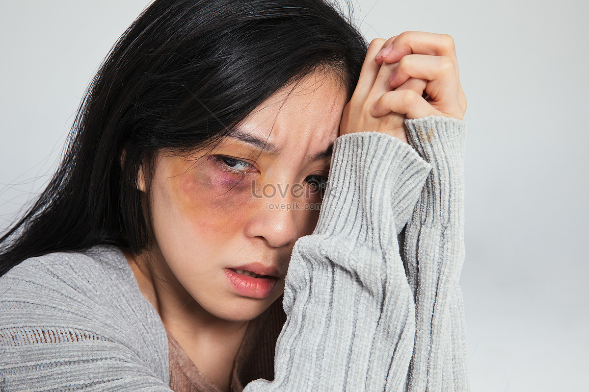 Woman Bruised By Domestic Violence Picture And HD Photos