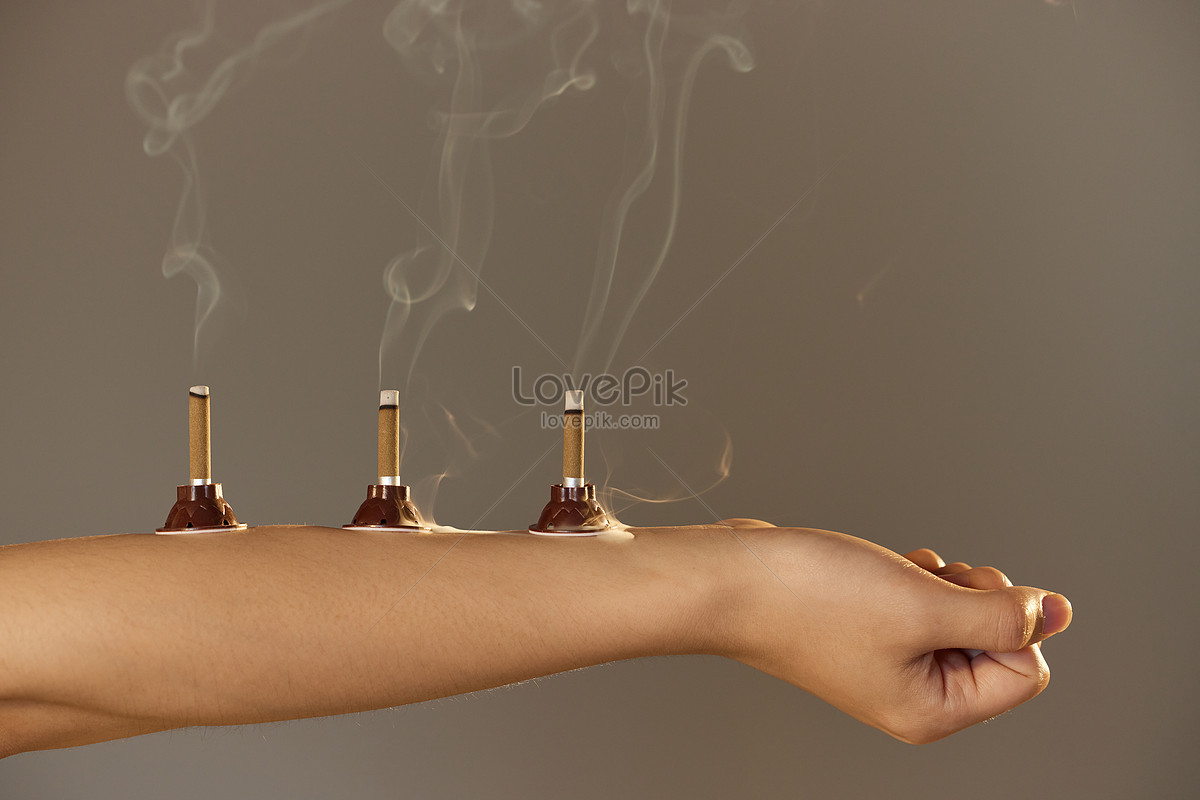 Traditional Chinese Medicine Moxibustion Picture And Hd Photos Free Download On Lovepik