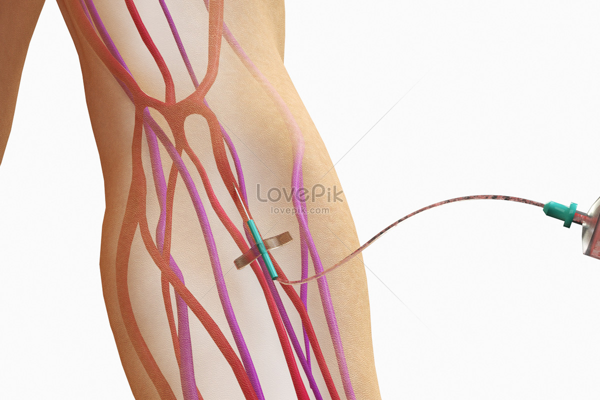 внутривенные инъекции изображение, внутривенные инъекции фото_Фоновое  изображение_ru.lovepik.com Бесплатная картинка