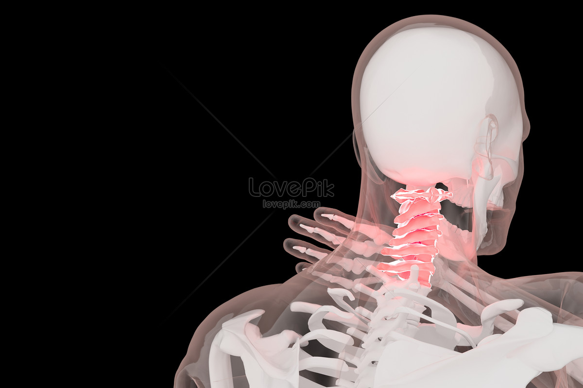 Three-dimensional cervical spondylosis scene creative image_picture ...