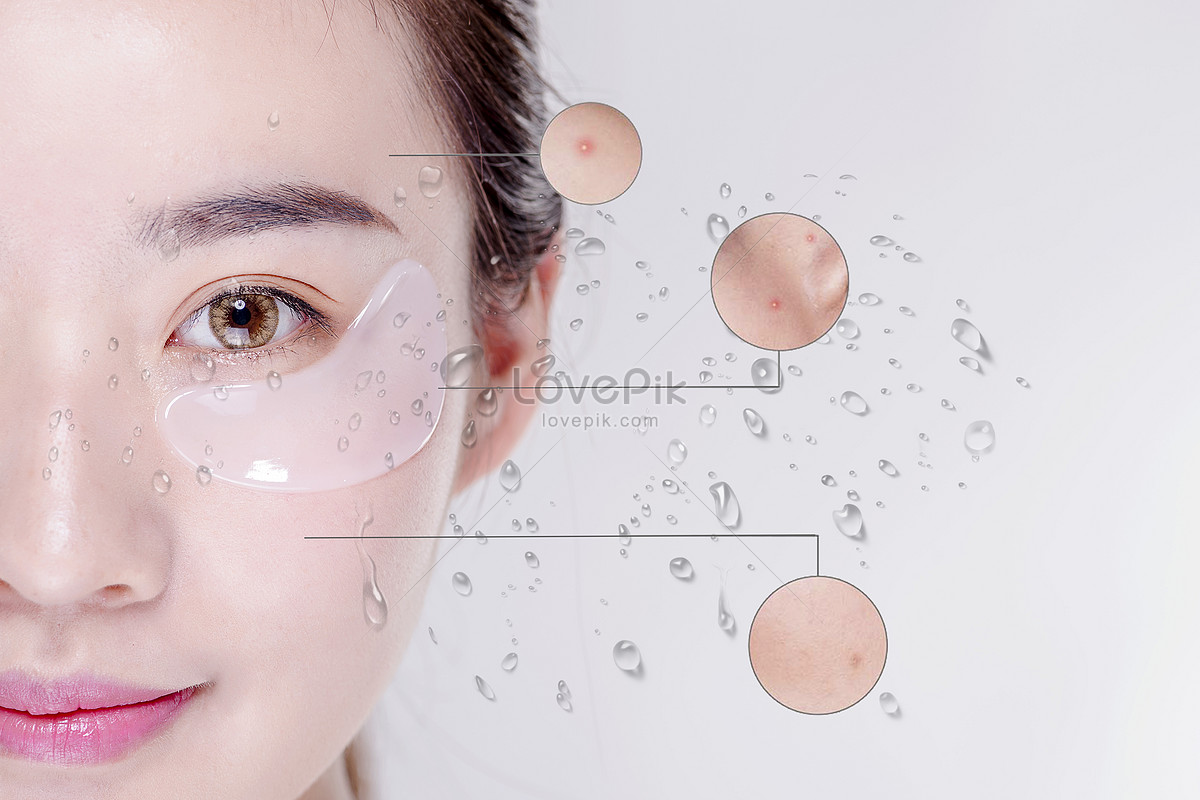 An Image Of A Girl With Spots On Her Face Background, Pictures Of Pimples,  Pimple, Pimples Background Image And Wallpaper for Free Download